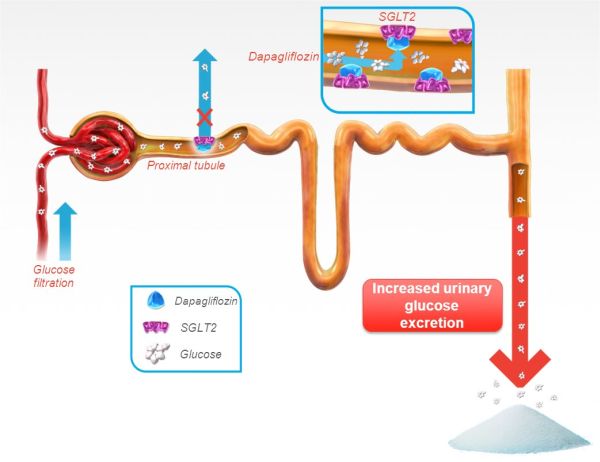 Σχηματική παράσταση τρόπου δράσης των αναστολέων συμμεταφορέων νατρίου γλυκόζης στον νεφρό