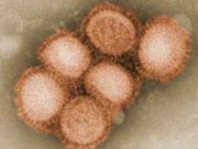 Ο ιός της γρίπης Α (Η1Ν1)