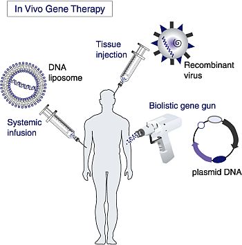 Γονιδιακή θεραπεία in vivo